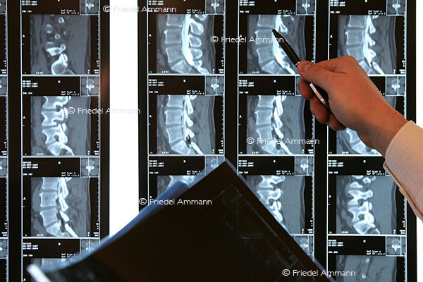LEBEN – Schulmedizin - Röntgendiagnostik