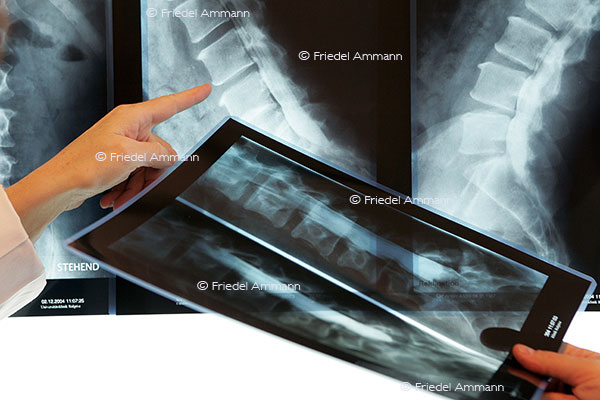LEBEN – Schulmedizin - Röntgendiagnostik