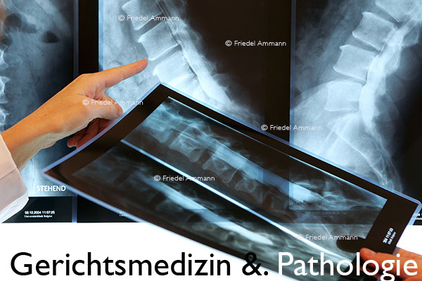 WIRTSCHAFT / ECONOMY - Forschung / Research - Röntgendiagnostik