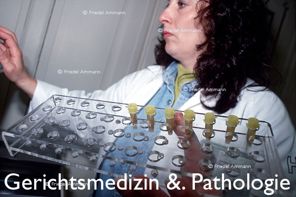 WIRTSCHAFT / ECONOMY - Forschung / Research – Rechtsmedizin, DNA-Test