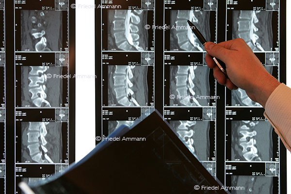 WIRTSCHAFT / ECONOMY - Gesundheitswesen / Health – Röntgendiagnostik / X-Ray Diagnostics